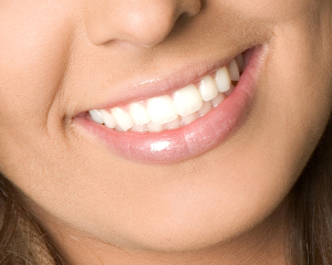 Cosmetic Dental Services Indianapolis